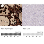 Anti-TG Antibody