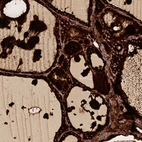 Immunohistochemical staining of human thyroid gland shows strong cytoplasmic positivity in glandular cells.