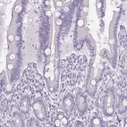 Immunohistochemical staining of human duodenum shows no positivity in glandular cells as expected.