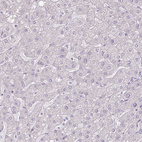Immunohistochemical staining of human liver shows no positivity in hepatocytes as expected.