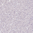 Anti-TG Antibody