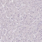 Immunohistochemical staining of human liver shows no positivity in hepatocytes as expected.