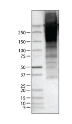 Anti-TG Antibody