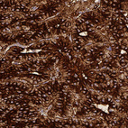 Immunohistochemical staining of human parathyroid gland shows strong cytoplasmic positivity in glandular cells.