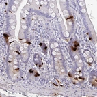 Immunohistochemical staining of human duodenum shows strong cytoplasmic positivity in enteroendocrine cells.