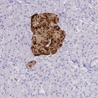 Immunohistochemical staining of human pancreas shows moderate to strong cytoplasmic positivity in islets of Langerhans.