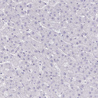 Anti-CHGA Antibody