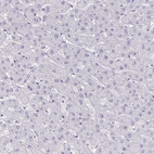 Immunohistochemical staining of human liver shows no positivity in hepatocytes as expected.