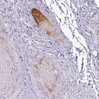 Anti-APOL1 Antibody