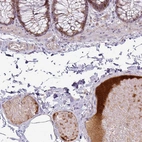 Immunohistochemical staining of human colon shows moderate to strong positivity in plasma in blood vessels.