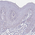 Immunohistochemical staining of human skin shows no positivity in squamous epithelial cells as expected.