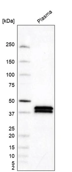 Western blot analysis in human plasma.