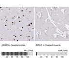 Anti-ADAR Antibody