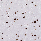 Immunohistochemical staining of human cerebral cortex shows strong nuclear positivity in neurons.