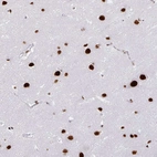 Immunohistochemical staining of human cerebral cortex shows strong nuclear positivity in neurons.