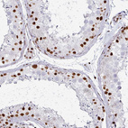 Immunohistochemical staining of human testis shows strong nuclear positivity in cells in seminiferous ducts.