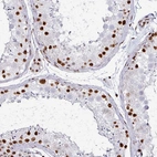 Immunohistochemical staining of human testis shows strong nuclear positivity in cells in seminiferous ducts.