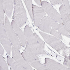 Immunohistochemical staining of human skeletal muscle shows no positivity in myocytes as expected.