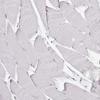Immunohistochemical staining of human skeletal muscle shows no positivity in myocytes as expected.