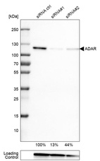Western blot analysis in U-251MG cells transfected with control siRNA, target specific siRNA probe #1 and #2, using Anti-ADAR antibody. Remaining relative intensity is presented. Loading control: Anti-GAPDH.