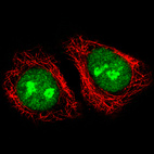 Immunofluorescence staining of A549 cells using the Anti-ADAR monoclonal antibody, showing specific staining in the nucleoplasm and nucleoli in green. Microtubule- and nuclear probes are visualized in red and blue, respectively (where available).