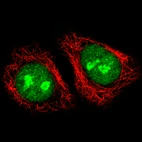 Immunofluorescence staining of A549 cells using the Anti-ADAR monoclonal antibody, showing specific staining in the nucleoplasm and nucleoli in green. Microtubule- and nuclear probes are visualized in red and blue, respectively (where available).