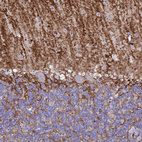 Anti-AQP4 Antibody