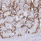 Anti-AQP4 Antibody