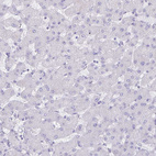 Anti-AQP4 Antibody