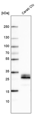 Western blot analysis in human cerebral cortex tissue.