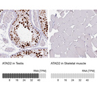 Anti-ATAD2 Antibody