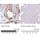Anti-ATAD2 Antibody