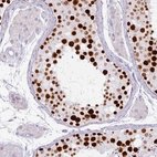 Immunohistochemical staining of human testis shows moderate to strong nuclear positivity in cells in seminiferous ducts.