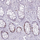 Immunohistochemical staining of human rectum shows strong nuclear positivity in a subset of glandular cells.