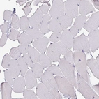 Immunohistochemical staining of human skeletal muscle shows no nuclear positivity in striated muscle fibers as expected.