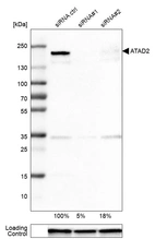 Western blot analysis in U-251MG cells transfected with control siRNA, target specific siRNA probe #1 and #2, using Anti-ATAD2 antibody. Remaining relative intensity is presented. Loading control: Anti-GAPDH.