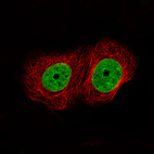 Anti-ATAD2 Antibody