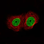 Immunofluorescence staining of MCF7 cells using the Anti-ATAD2 monoclonal antibody, showing specific staining in nucleoplasm in green. Microtubule- and nuclear probes are visualized in red and blue, respectively (where available).