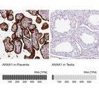 Anti-ANXA1 Antibody