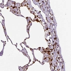 Immunohistochemical staining of human lung shows strong nuclear positivity in a subset of pneumocytes and lymphoid cells.