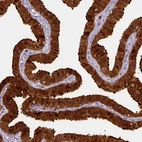 Immunohistochemical staining of human fallopian tube shows strong positivity in glandular cells.