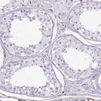 Immunohistochemical staining of human testis shows no positivity in cells in seminiferous ducts as expected.