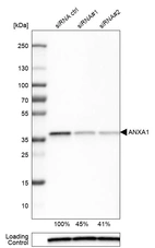 Western blot analysis in U-251MG cells transfected with control siRNA, target specific siRNA probe #1 and #2, using Anti-ANXA1 antibody. Remaining relative intensity is presented. Loading control: Anti-PPIB.