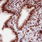 Anti-EMD Antibody