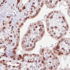 Immunohistochemical staining of human placenta shows strong immunoreactivity in the nuclear membrane in the trophoblast layer.