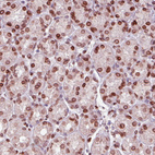 Anti-EMD Antibody