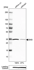 Western blot analysis in RT-4 cells transfected with control siRNA, target specific siRNA probe #1, using Anti-EMD antibody. Remaining relative intensity is presented. Loading control: Anti-PPIB.