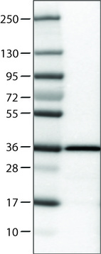 Anti-EMD Antibody