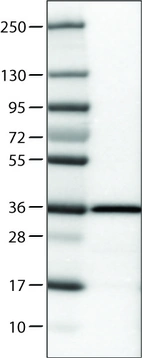 Lane 1: Marker [kDa]_br/_Lane 2: Human cell line RT-4