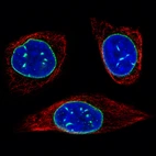 Immunofluorescence staining of PC-3 cells using the Anti-EMD monoclonal antibody, showing specific staining in the nuclear membrane in green. Microtubule- and nuclear probes are visualized in red and blue, respectively (where available).